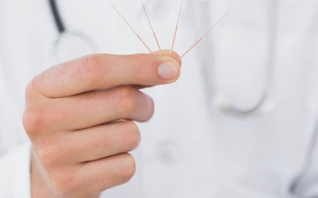 Defining Acupuncture’s Place in Western Medicine