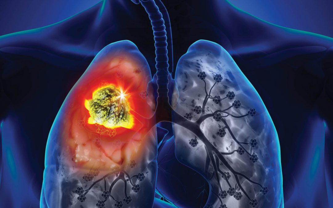Dr Samantha Meenach – A Three-Dimensional Model of Lung Cancer