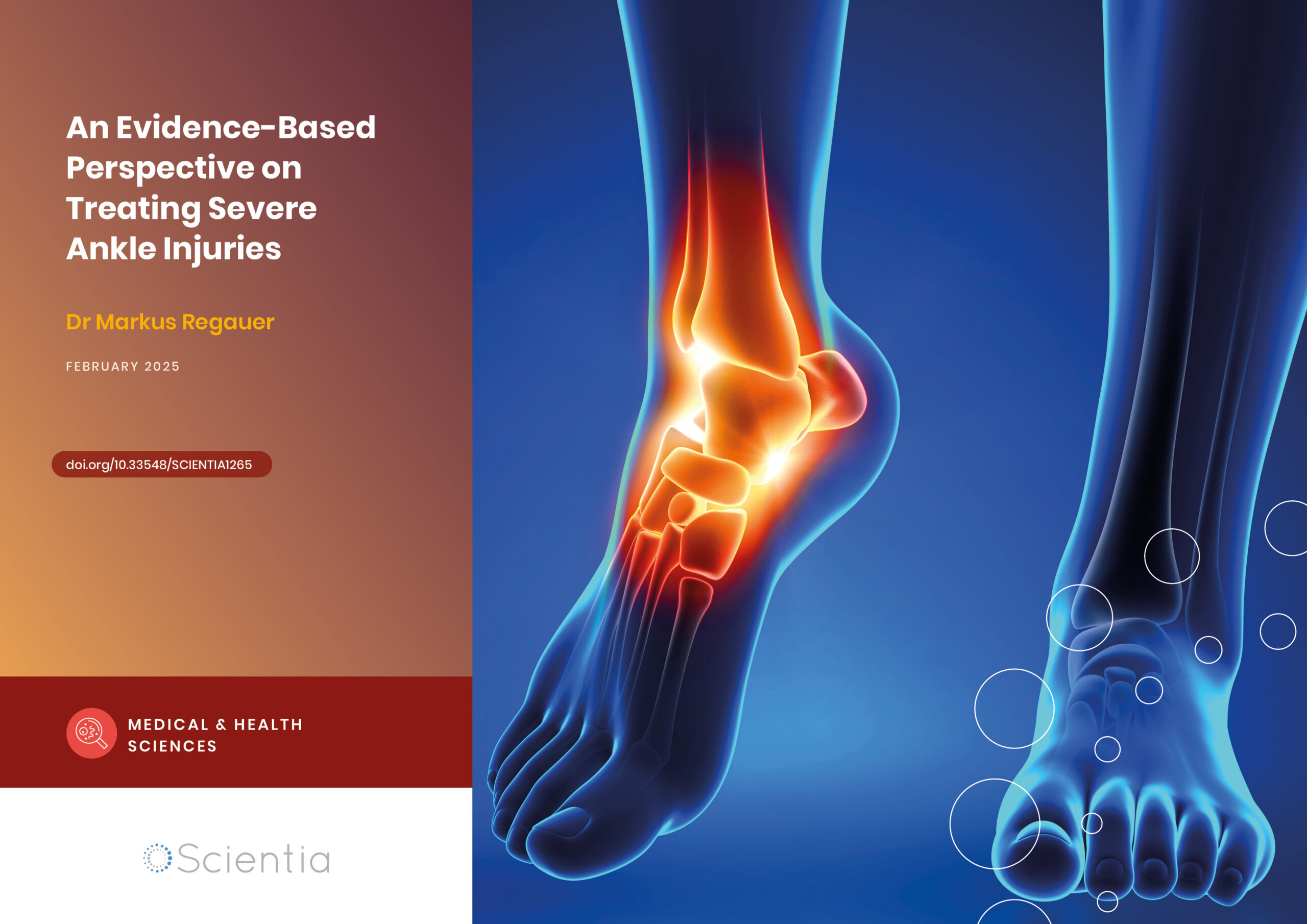 Dr Markus Regauer | An Evidence-Based Perspective on Treating Severe Ankle Injuries