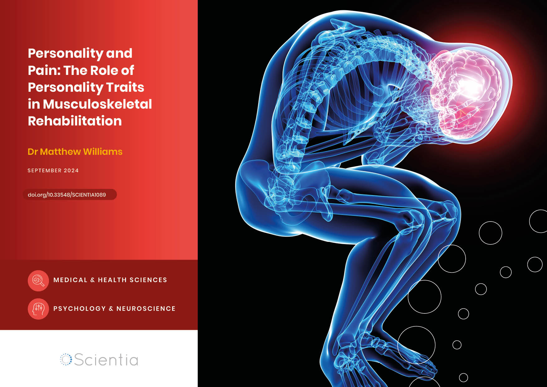 Dr Matthew Williams | Personality and Pain: The Role of Personality Traits in Musculoskeletal Rehabilitation