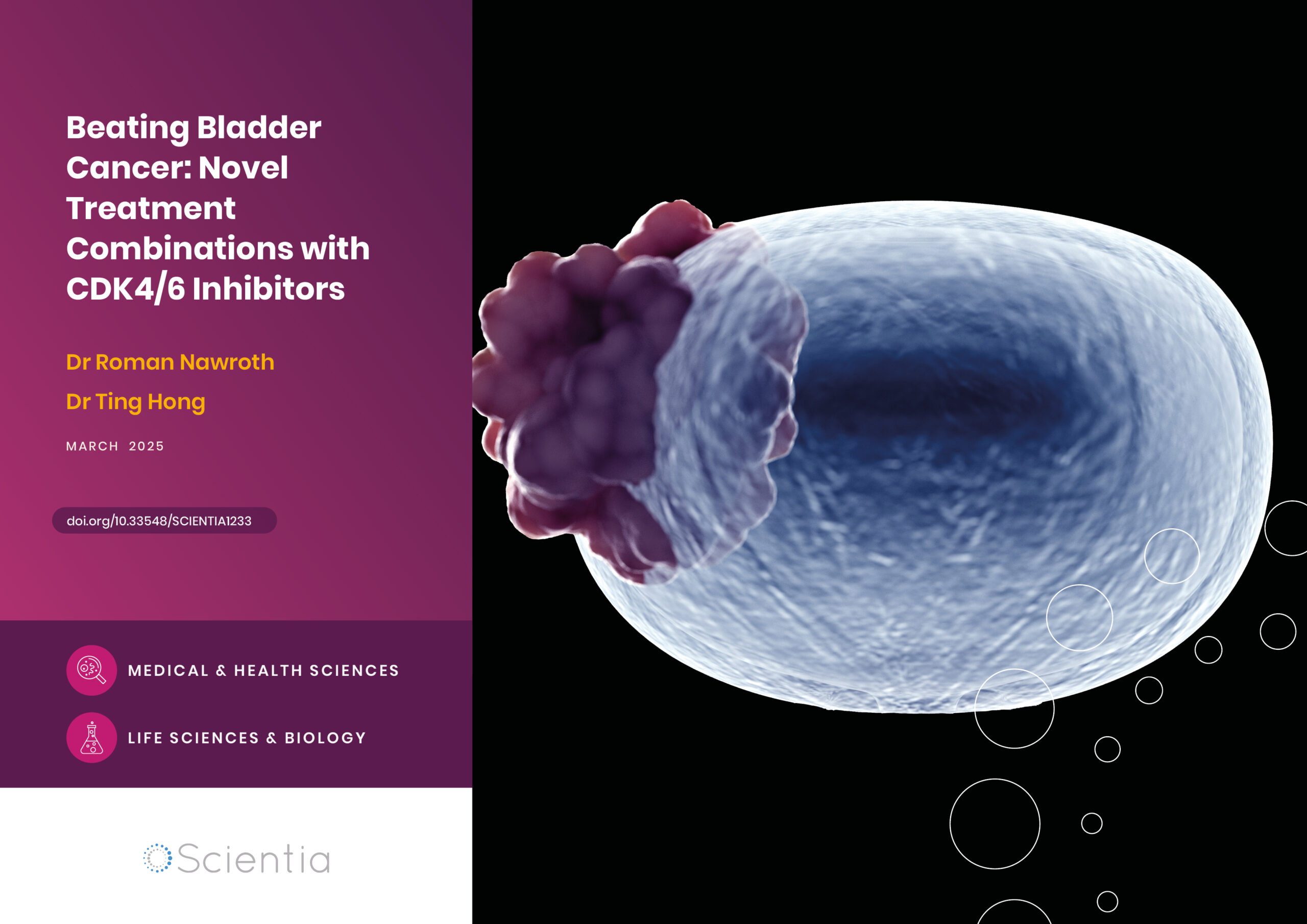 Beating Bladder Cancer: Novel Treatment Combinations with CDK4/6 Inhibitors