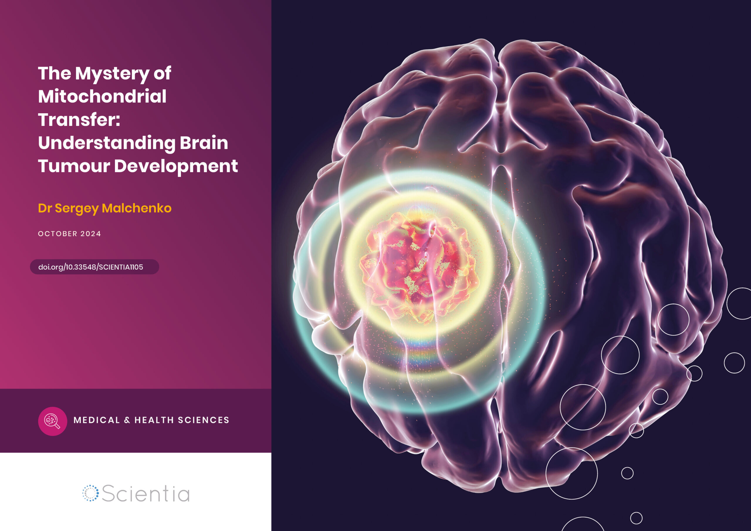 Dr Sergey Malchenko | The Mystery of Mitochondrial Transfer: Understanding Brain Tumour Development