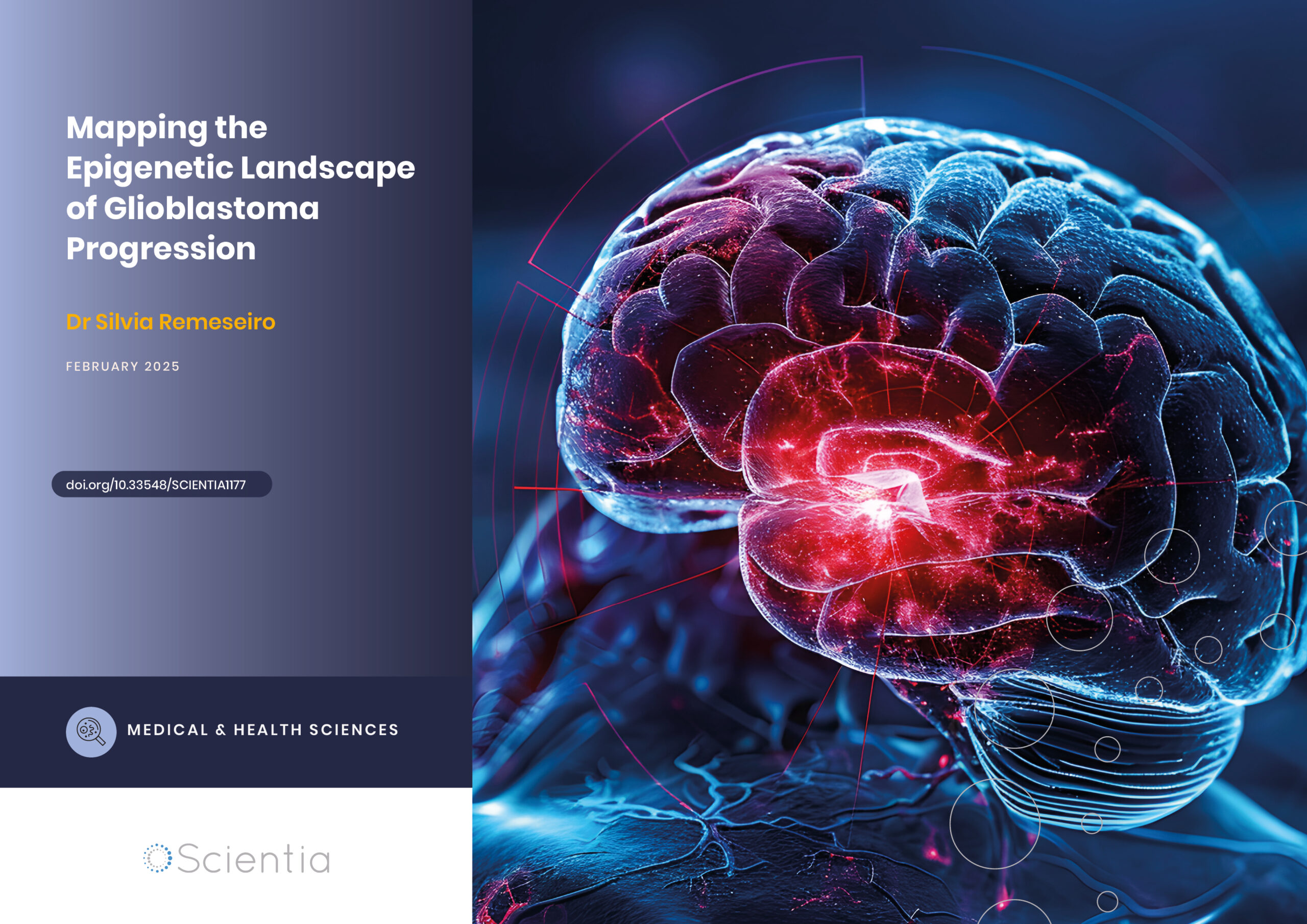 Dr Silvia Remeseiro | Mapping the Epigenetic Landscape of Glioblastoma Progression