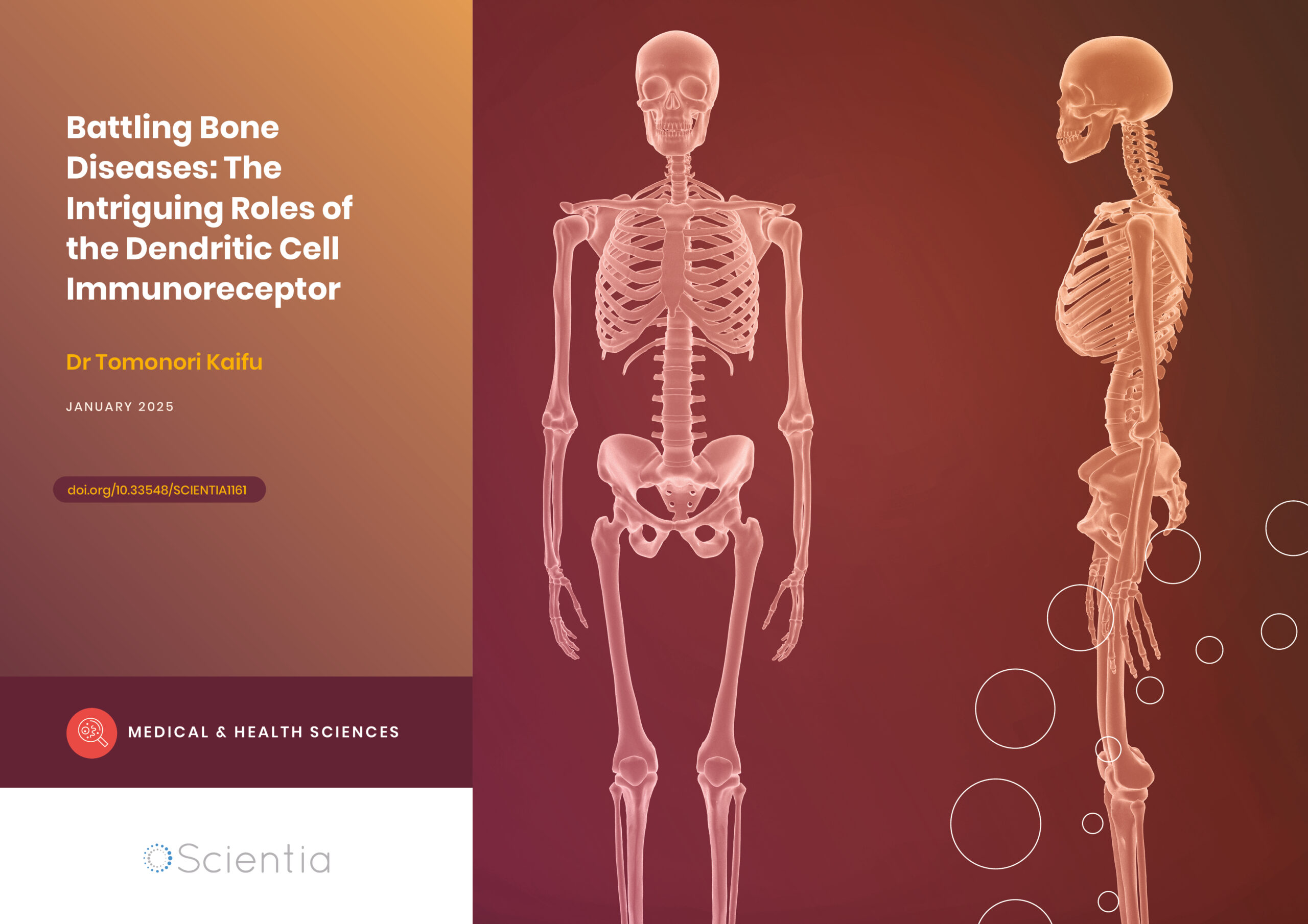 Dr Tomonori Kaifu | Battling Bone Diseases: The Intriguing Roles of the Dendritic Cell Immunoreceptor