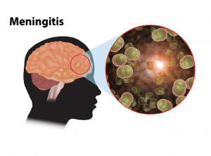 Meningitis Research Foundation • scientia.global